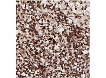 AKT phospho T308 Antibody