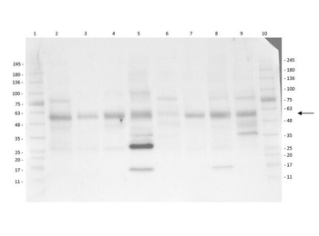 AKT phospho T308 Antibody