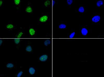 Histone H3 phospho T6 Antibody