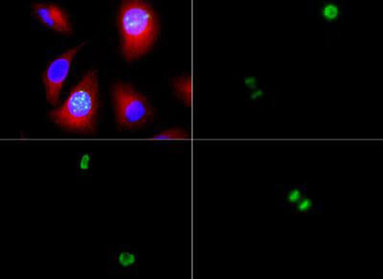 Histone H3 phospho S10 Antibody
