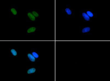 Histone H3 R17me2a Antibody