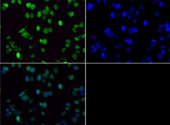 Histone H3 K36me2 Antibody