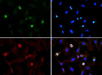 Histone H3 K56me3 Antibody