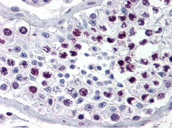 CCNA2 Antibody