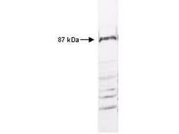 IKBKB Antibody
