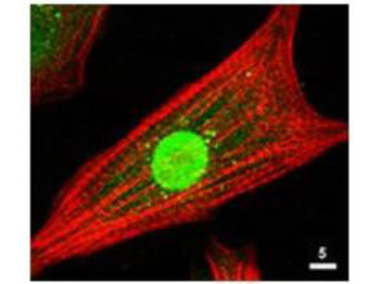 AKT1 Antibody