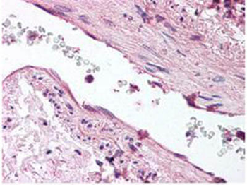 Angpt1 Antibody