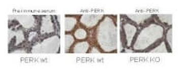 Eif2ak3 Antibody
