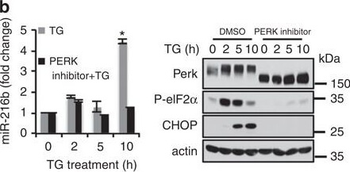 Eif2ak3 Antibody