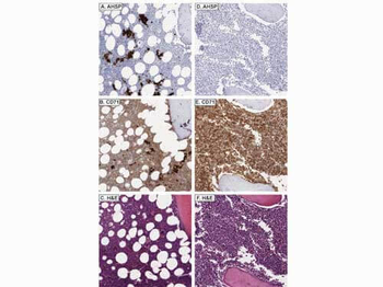AHSP Antibody
