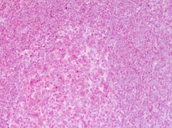 RELA Antibody