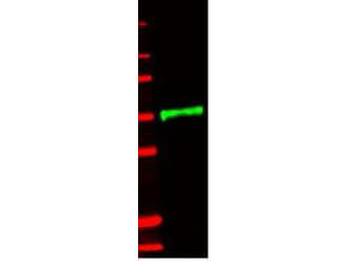 IL1R2 Antibody
