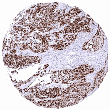 p53 antibody
