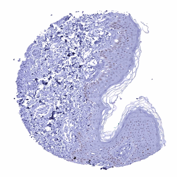 p53 antibody