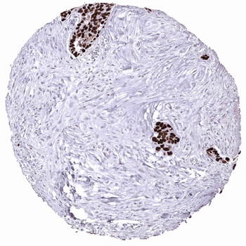p53 antibody