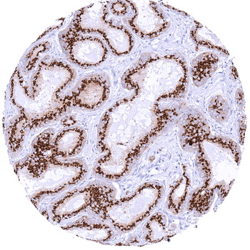 Prostein antibody