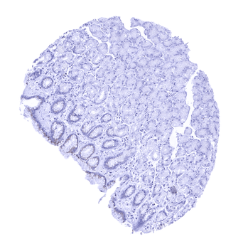 Prostein antibody
