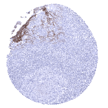Desmoglein 3 antibody