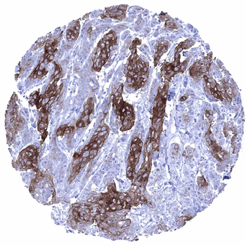 Desmoglein 1 antibody