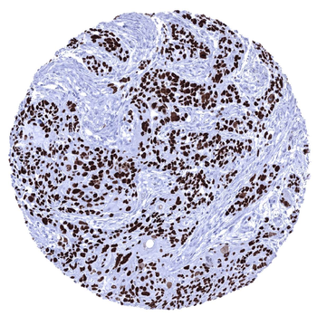p63 antibody