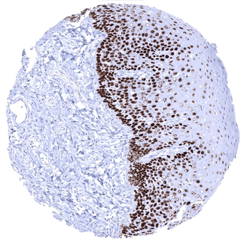 p63 antibody