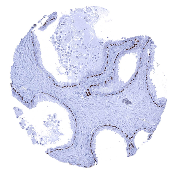 p63 antibody