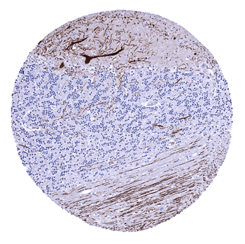 Calbindin 1 antibody (MSVA-471M)