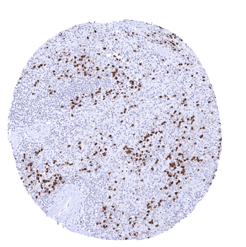 S100A12 antibody
