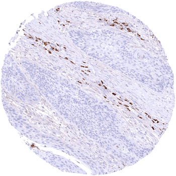 IgA antibody
