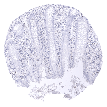 Transcription factor E3 / TFE3 antibody