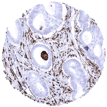 HLA-DRa antibody
