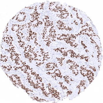 INSM1 antibody