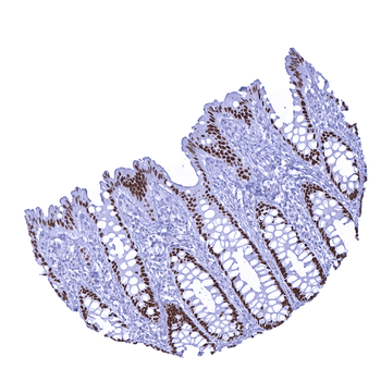 SATB2 antibody