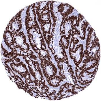 SATB2 antibody