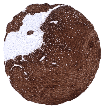 Cytokeratin 15 antibody
