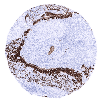 Cytokeratin 15 antibody