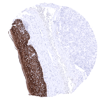 Cytokeratin 15 antibody