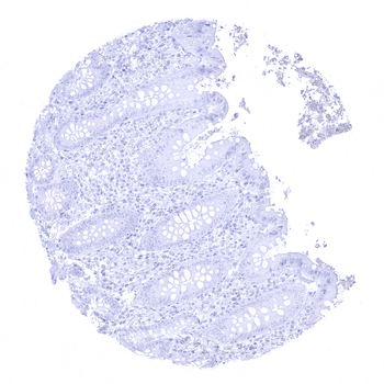 PSAP antibody