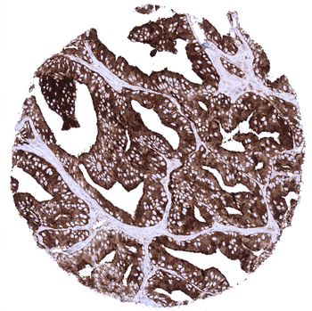 PSAP antibody