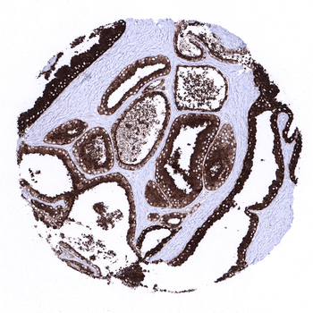 PSAP antibody