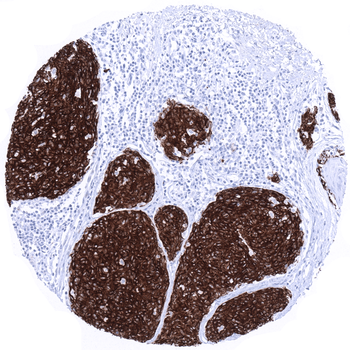 Melan A Specific antibody