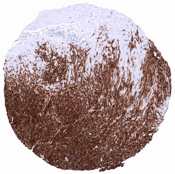 Dog1 antibody