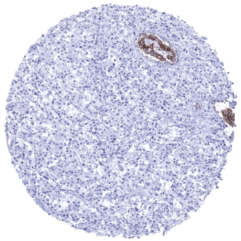 E-Cadherin