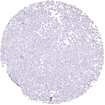 E-Cadherin