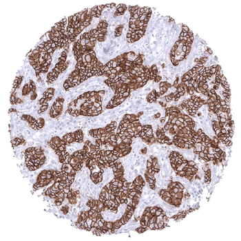 E-Cadherin
