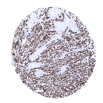 Cytokeratin, Pan antibody