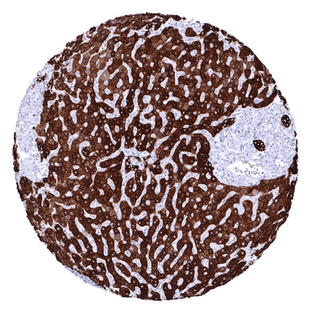 Cytokeratin, Pan antibody