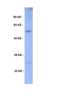 CDK8 Rabbit Polyclonal Antibody