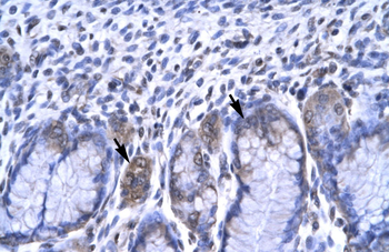 RBPSUH Rabbit Polyclonal Antibody