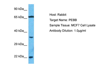 CBFB Rabbit Polyclonal Antibody